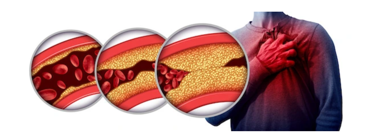 Was-bedeutet-cholesterin